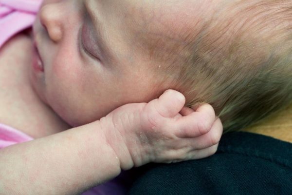 Mother Found a Tick in Her Daughter’s Ear: The Hidden Danger Lurking in Every Skin Fold of Children!